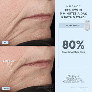 NuFACE TRINITY+ Wrinkle Reducer Attachment