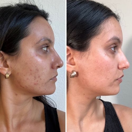 Before & After