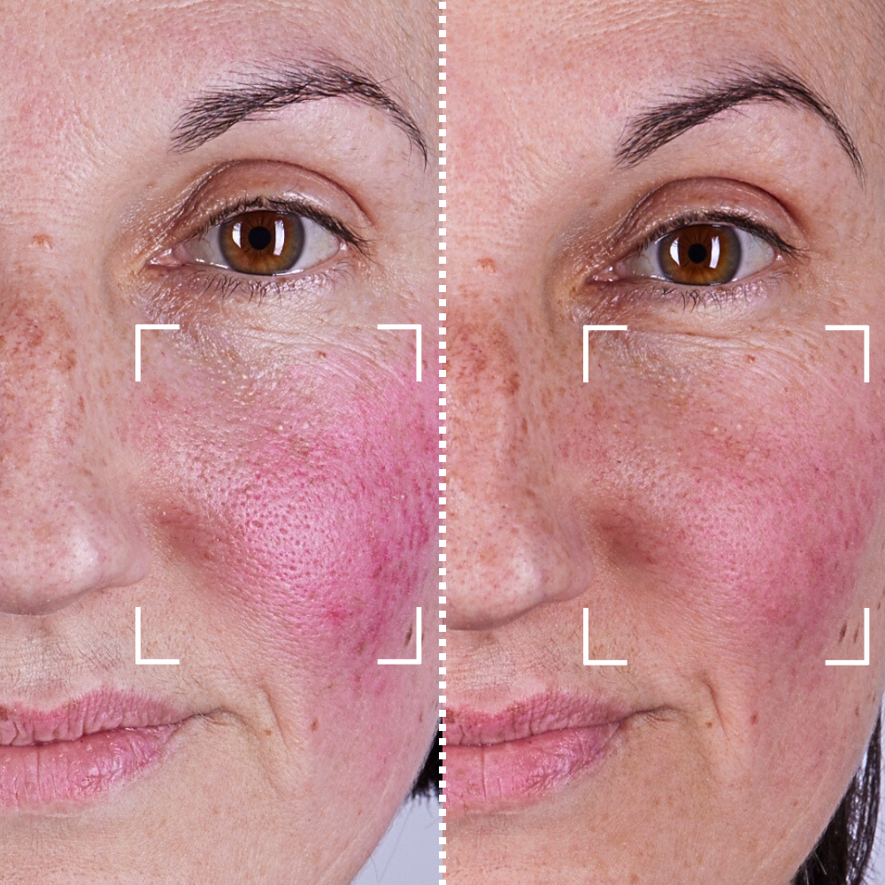 Before & After