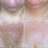 Improves skin texture