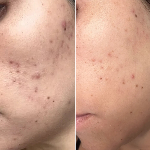 Before & After