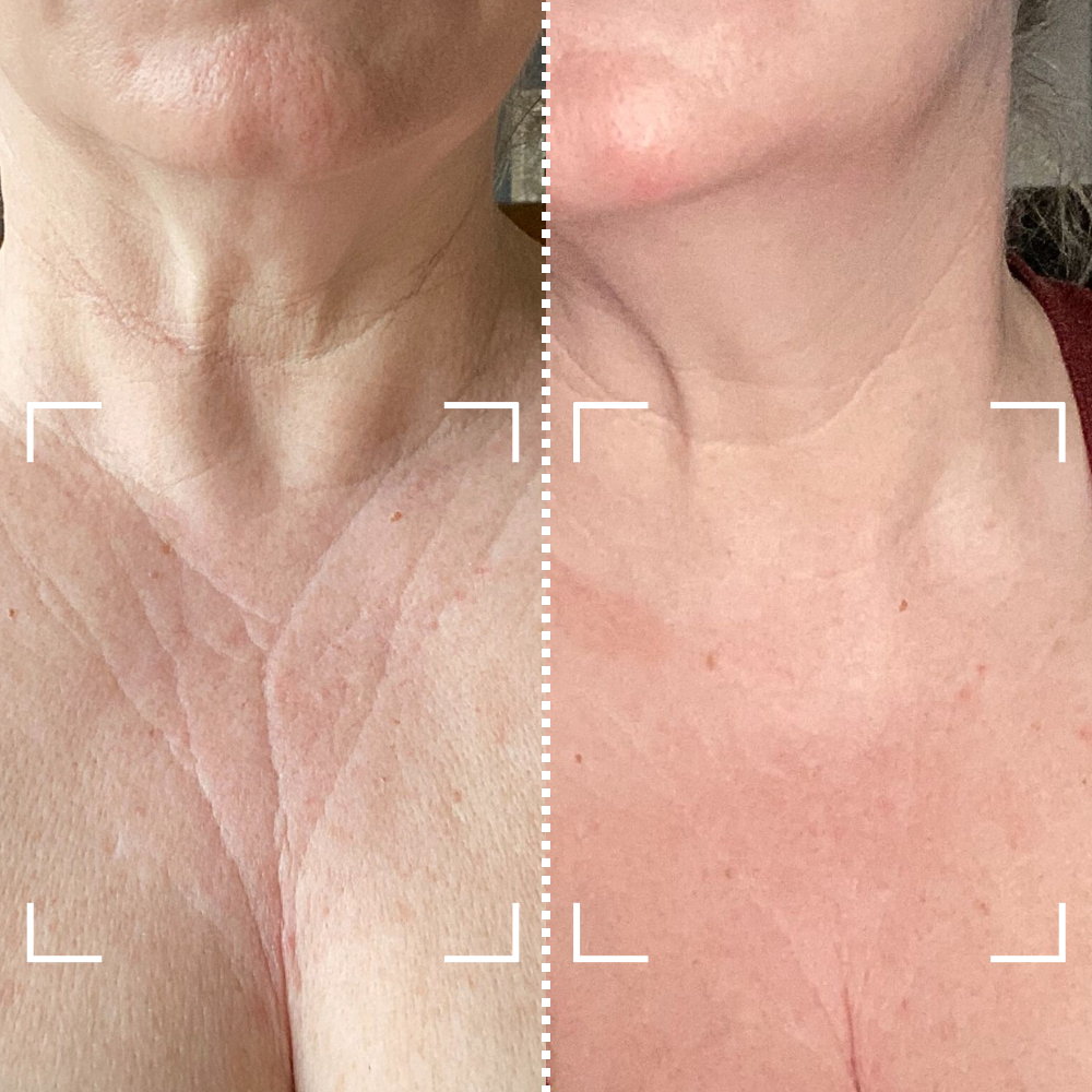 Before & After