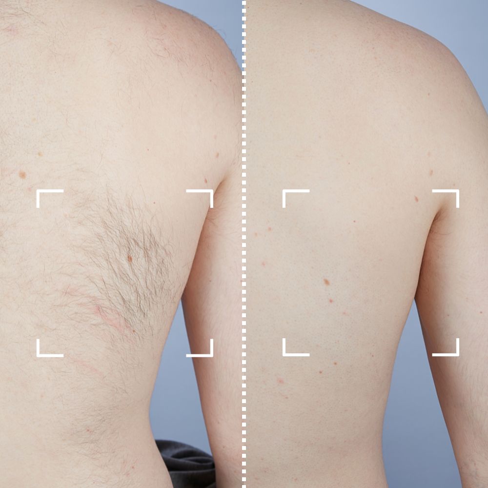 Before & After