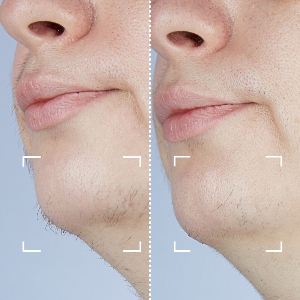 Before & After