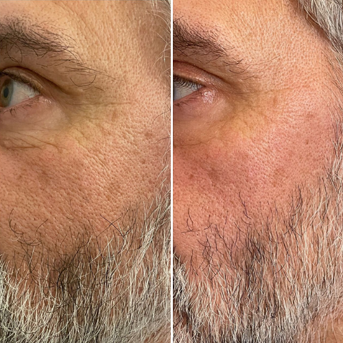 


Before &amp; After