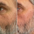 Reduce fine lines & wrinkles