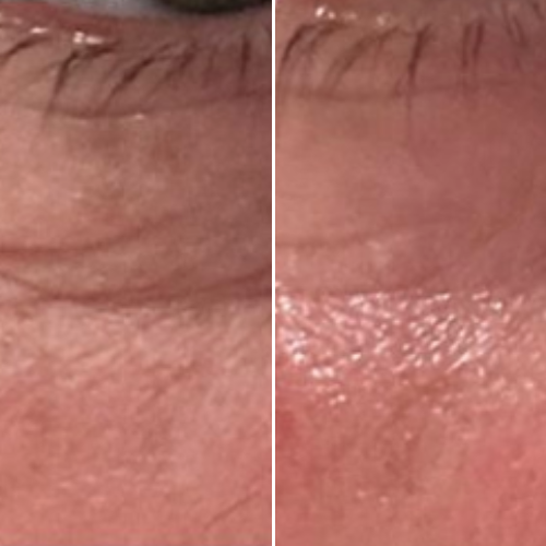 


Before &amp; After