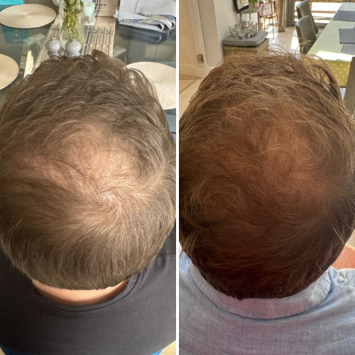 Before & After