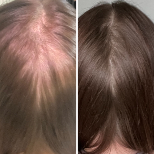 Before & After