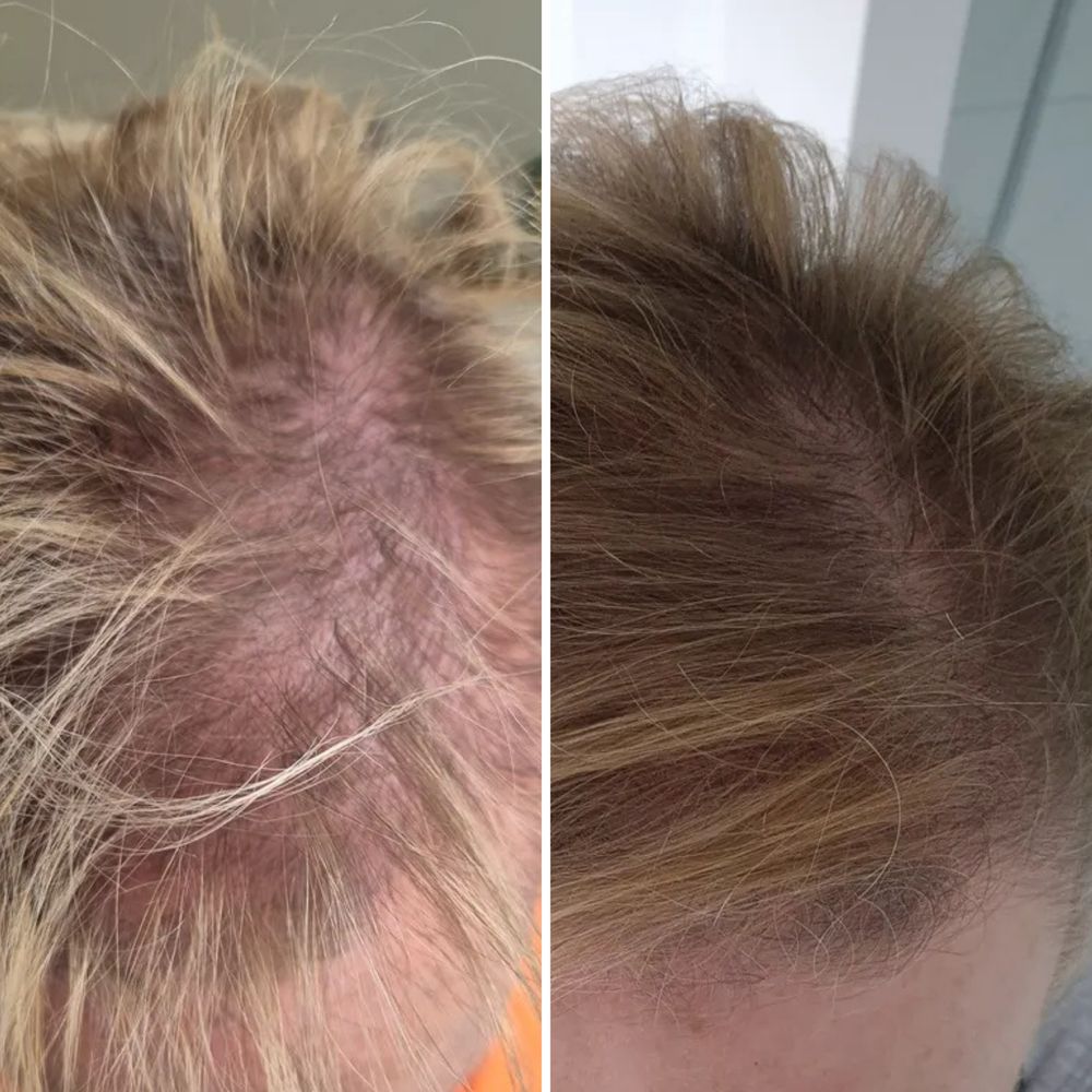Before & After