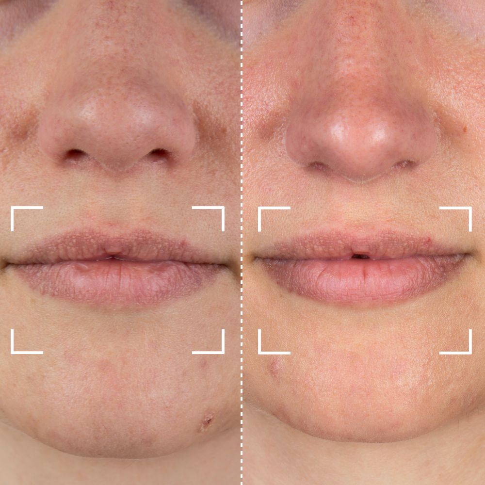 Before & After