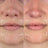 Smoothed fine lines