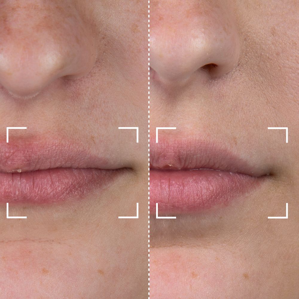 Before & After