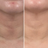 Smooths & plumps skin