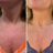 Even skin tone & texture
