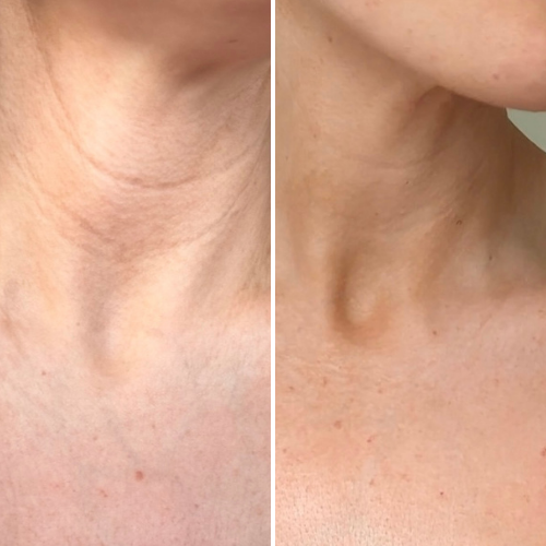 Before & After