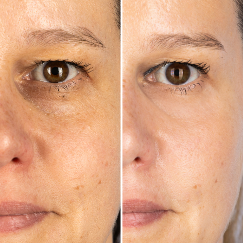 


Before &amp; After