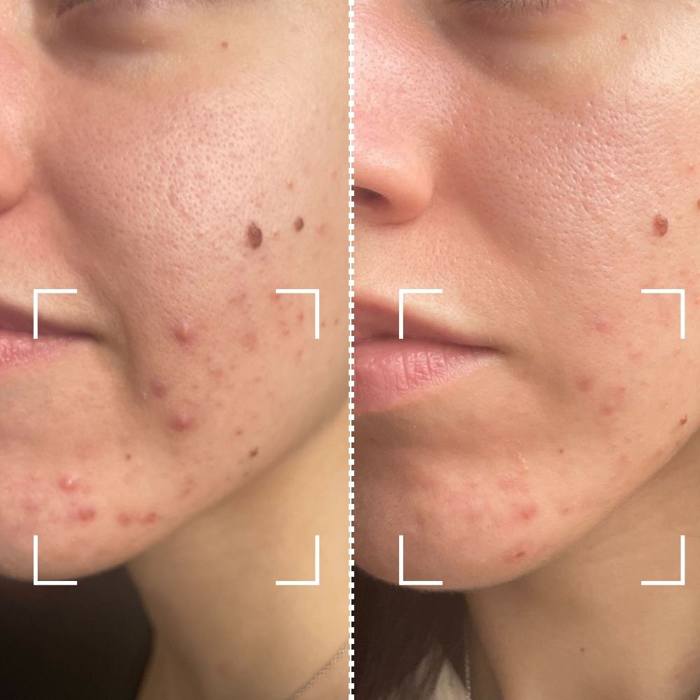 Before & After