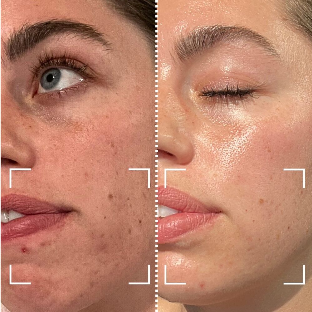 Before & After