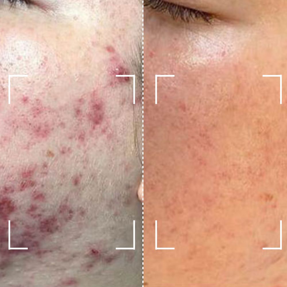 Before & After