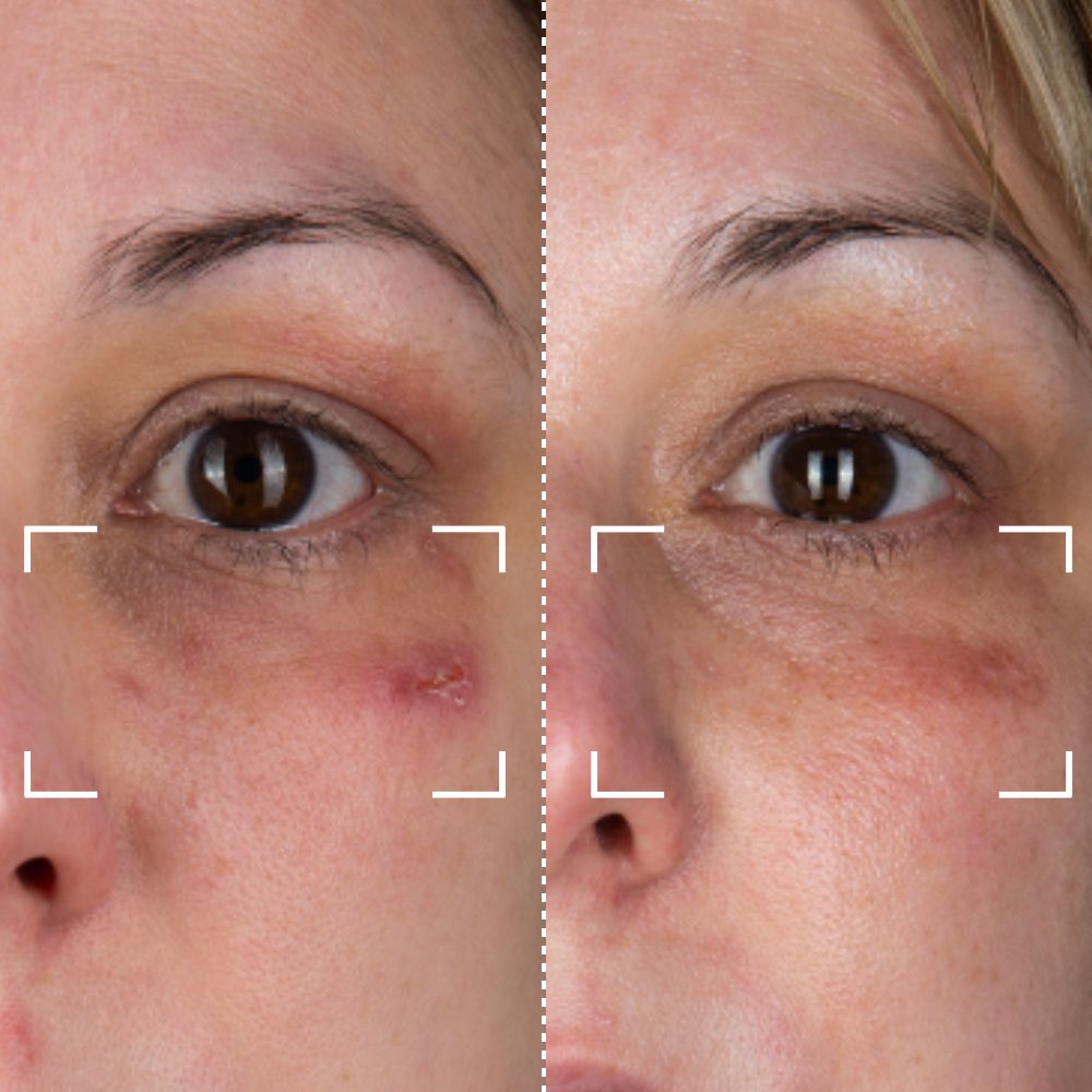 Before & After