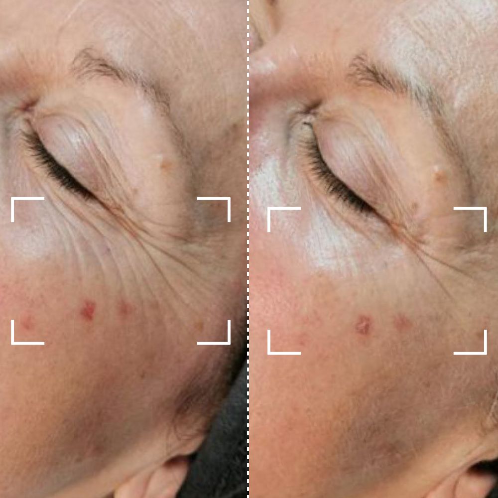 Before & After