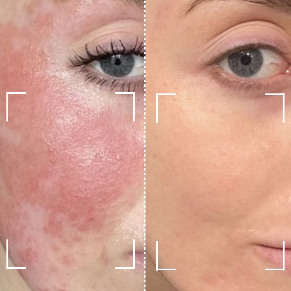 Before & After