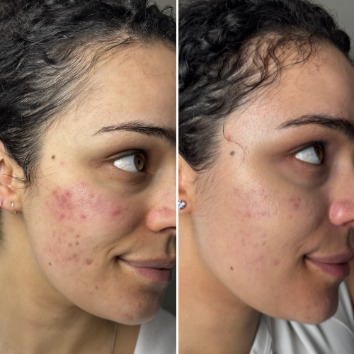 Before & After