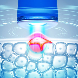 FOREO ESPADA™ 2 Blue Light Acne Treatment Device