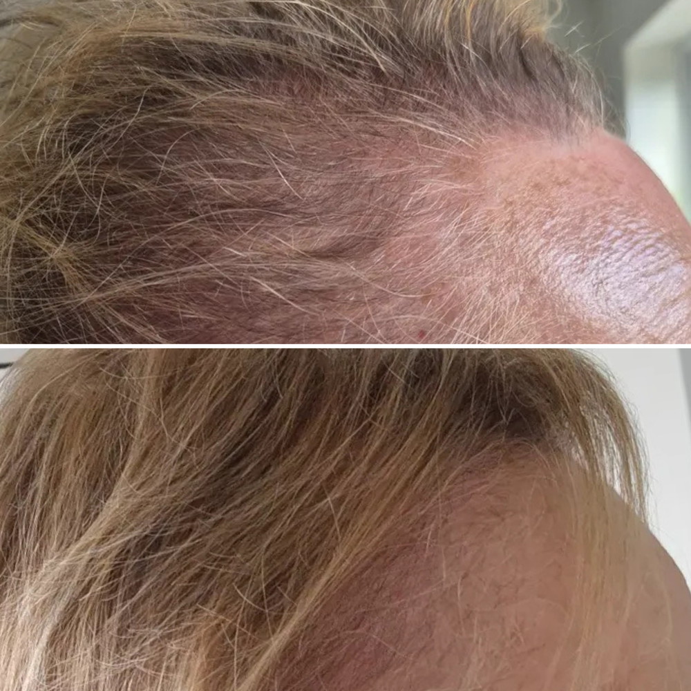 Before & After