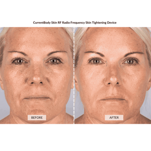 CurrentBody Skin Complete Anti-Ageing Facial Kit