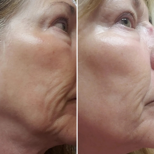 Before & After