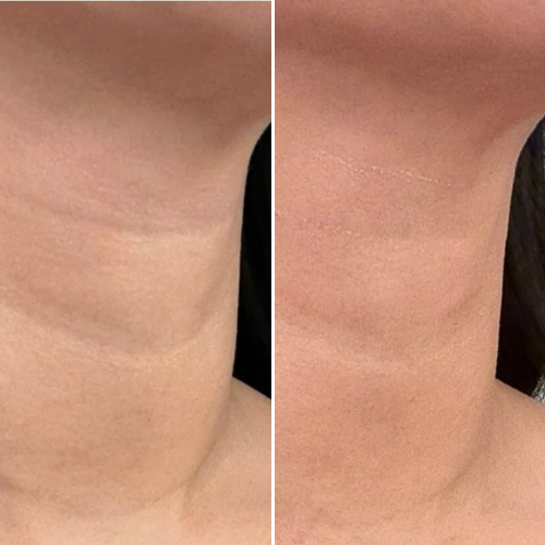Before & After