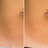 Evens skin texture