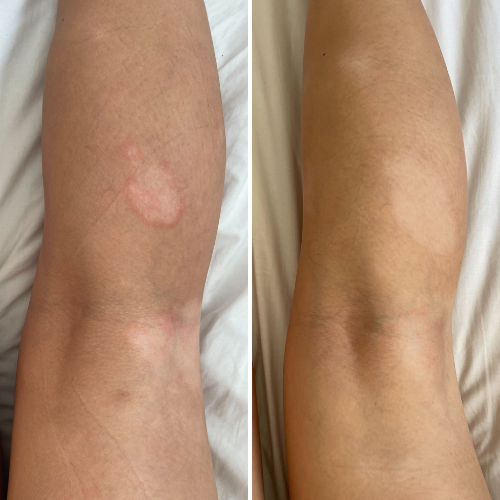 


Before &amp; After