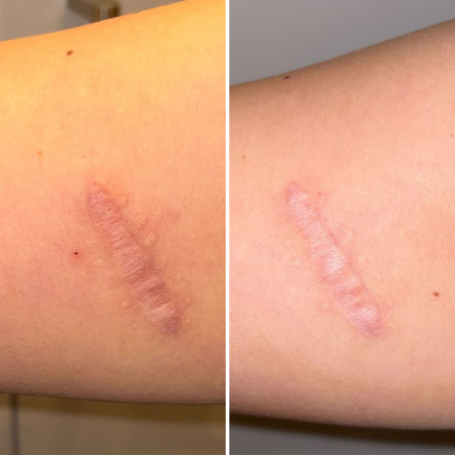 


Before &amp; After