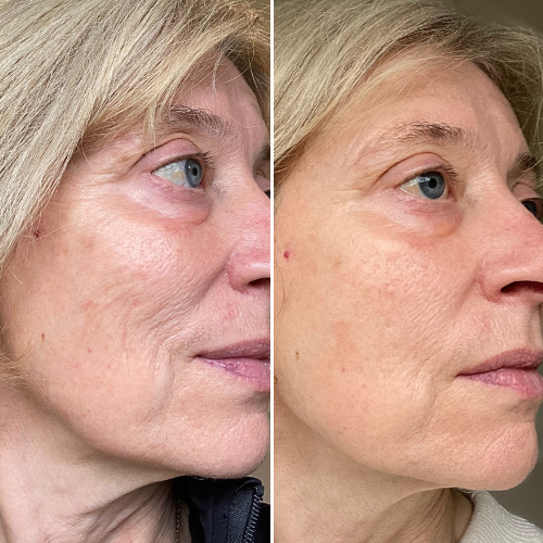 Before & After