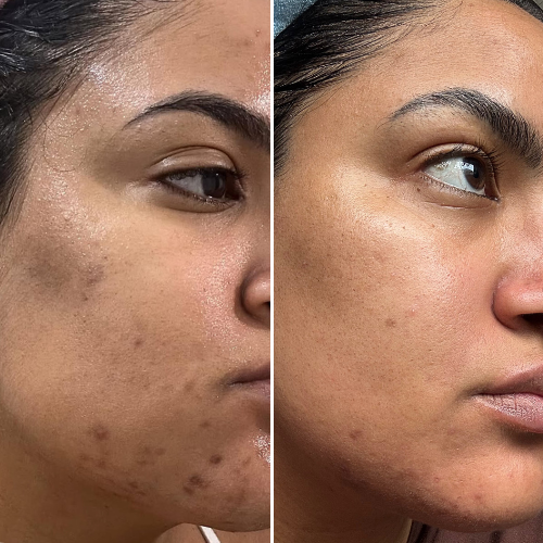Before & After