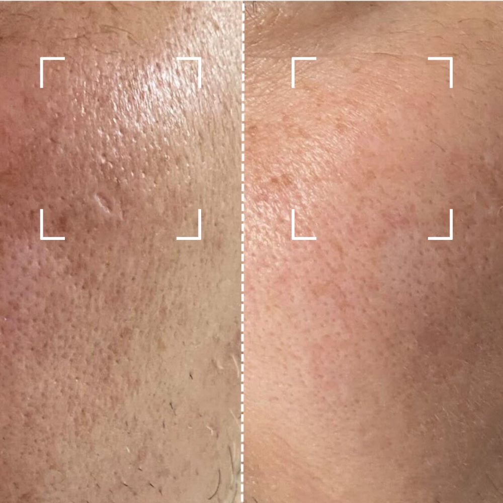 Before & After