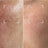 Improves skin texture