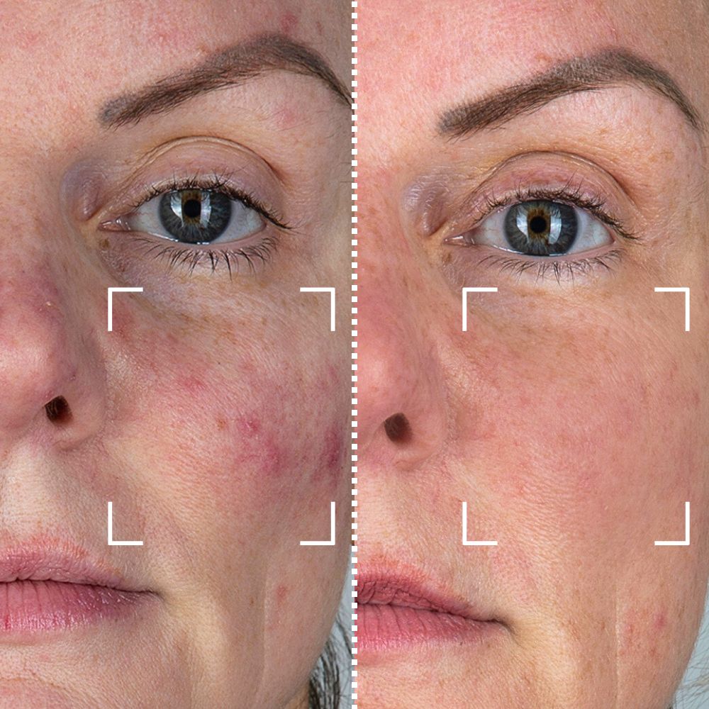Before & After