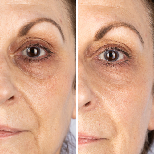 


Before &amp; After