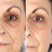 Increases collagen production