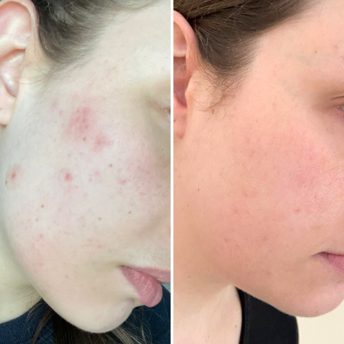 Before & After