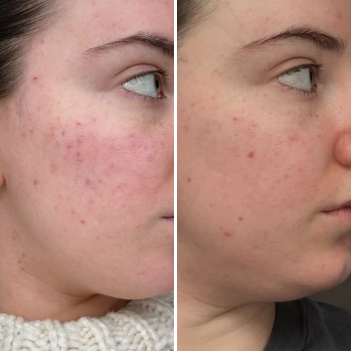 Before & After