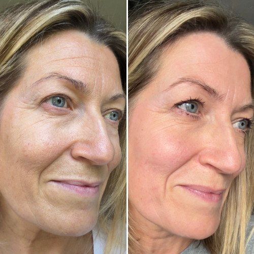 Before & After
