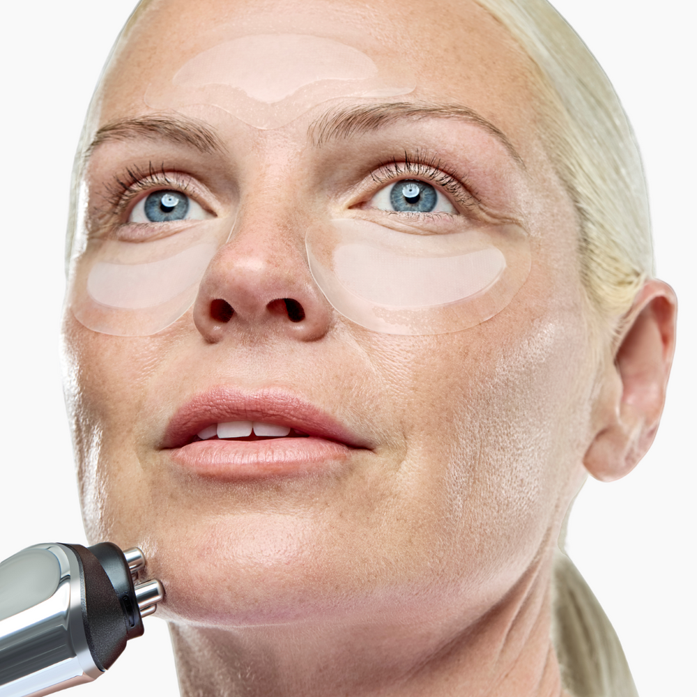 RF Microneedling Treatment | At Home Microneedling with Radio