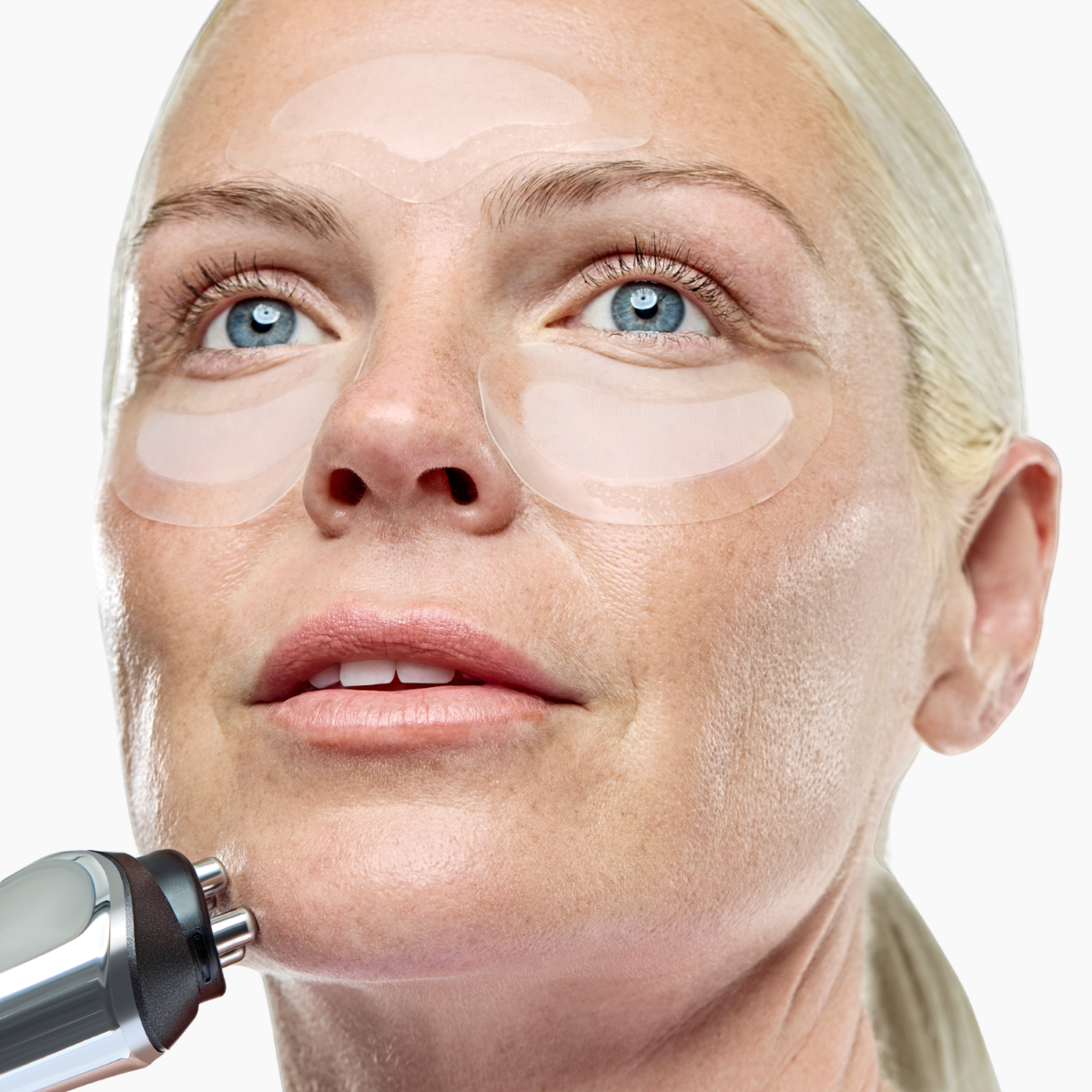 RF Microneedling Treatment | At Home Microneedling with Radio