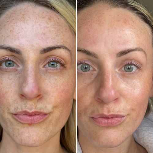 Before & After