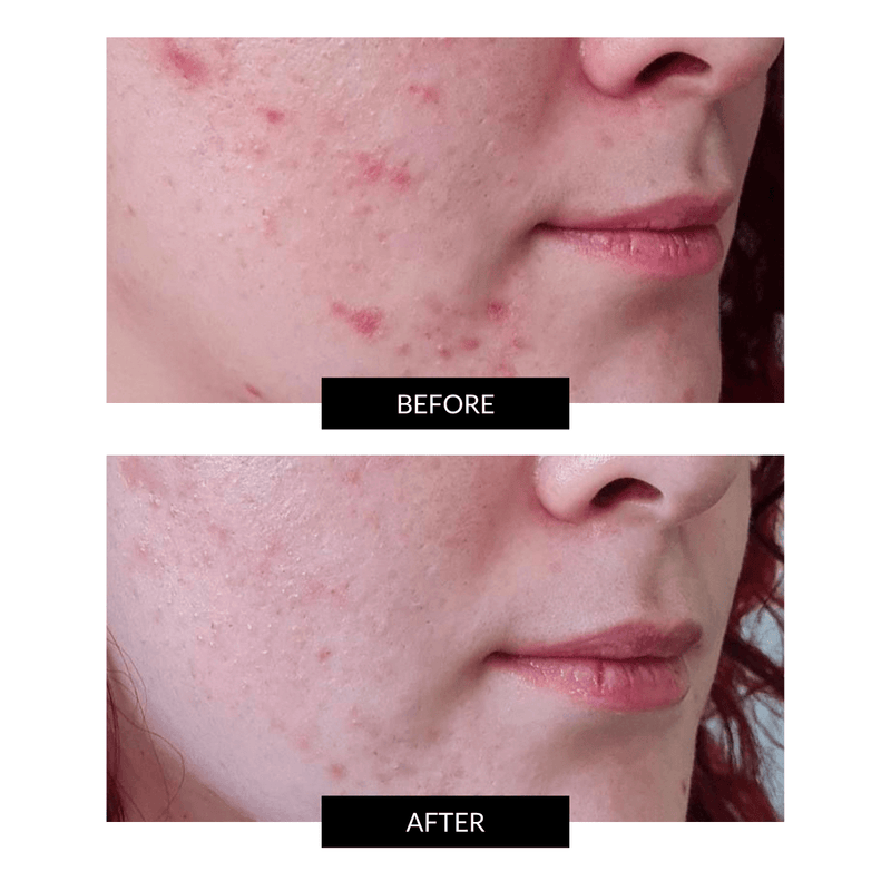 FACEGYM Face Coach Oil (15/30ml) CurrentBody IE